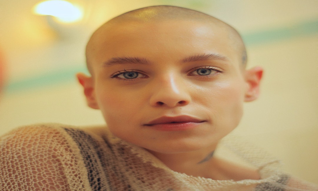 Alopecia ~ More To Beauty Than The Hair