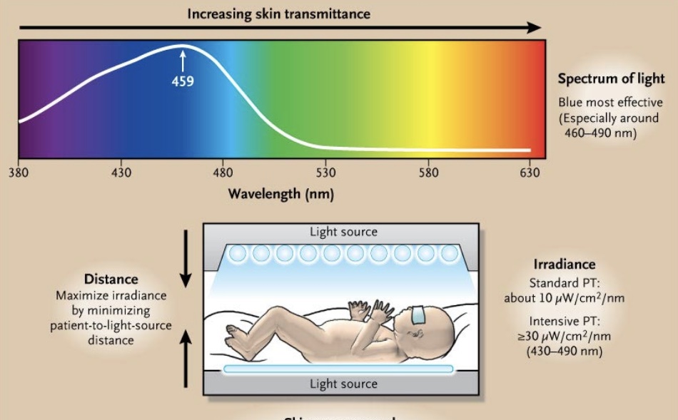 phototherapy is a treatment for jaundice in babies