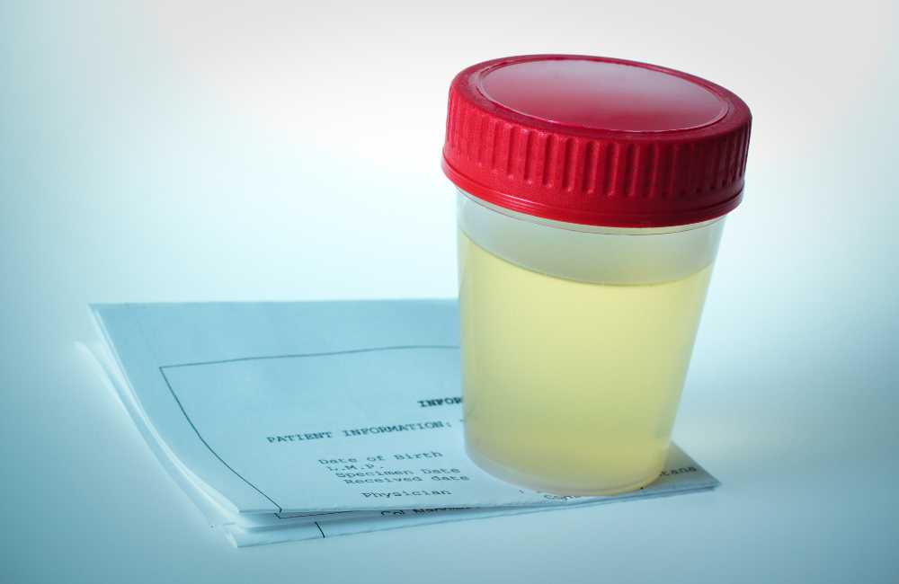 Urine in a container for screening
