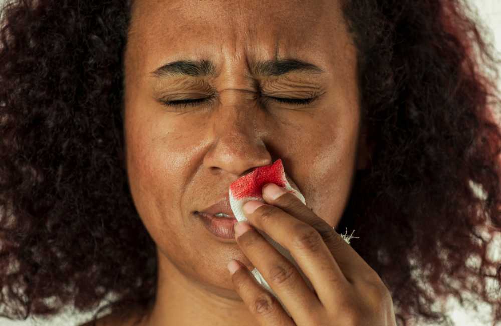 Nosebleed (Epistaxis) – Causes and Treatment